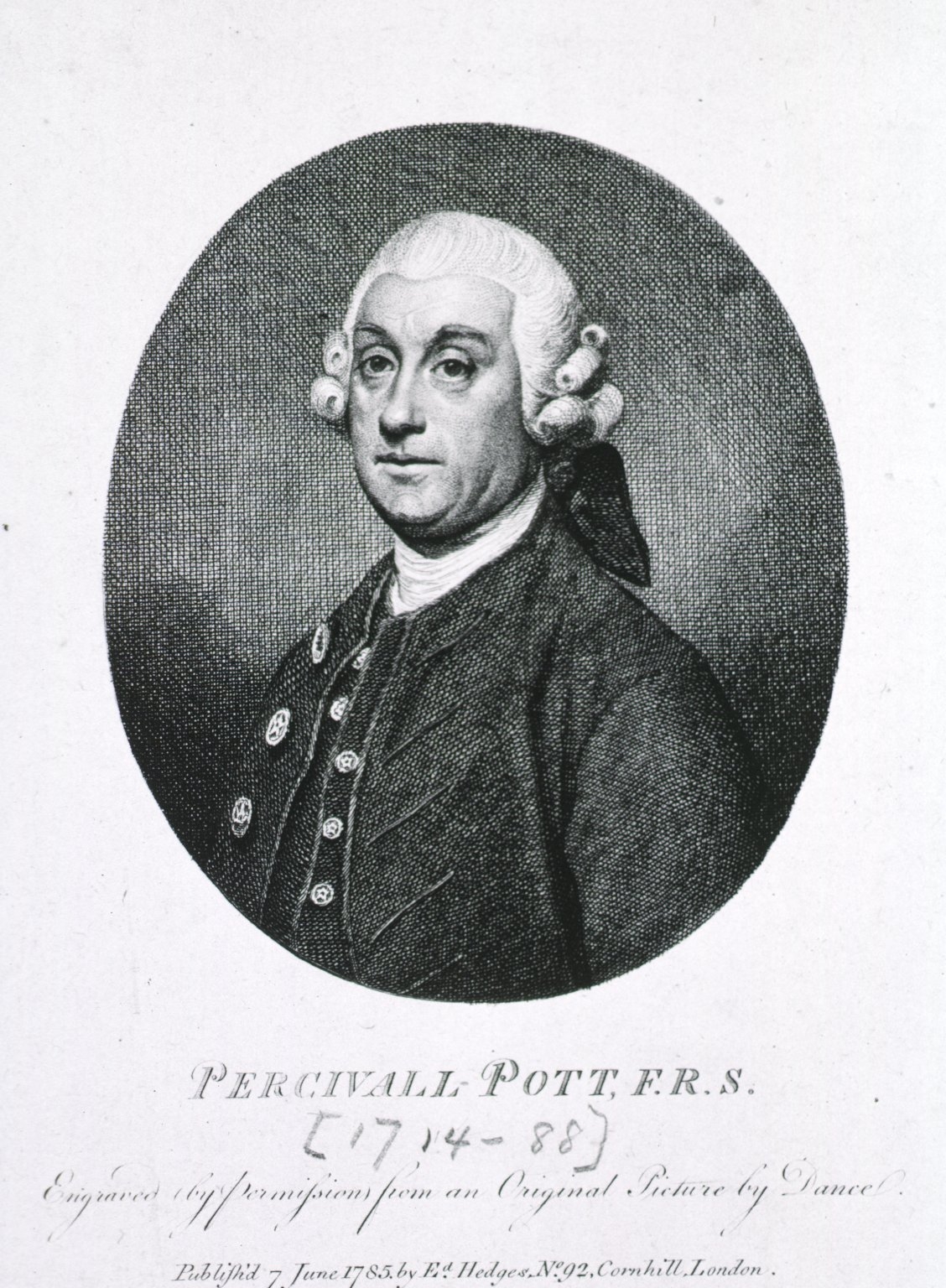 POTT, Percivall (1714 – 1788)