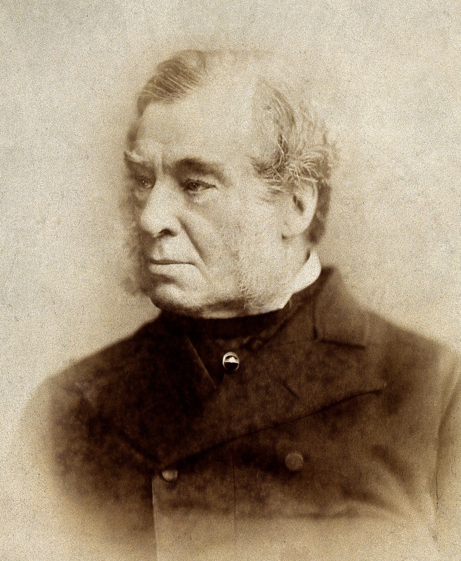 ADDISON, Thomas (1793 – 1860)