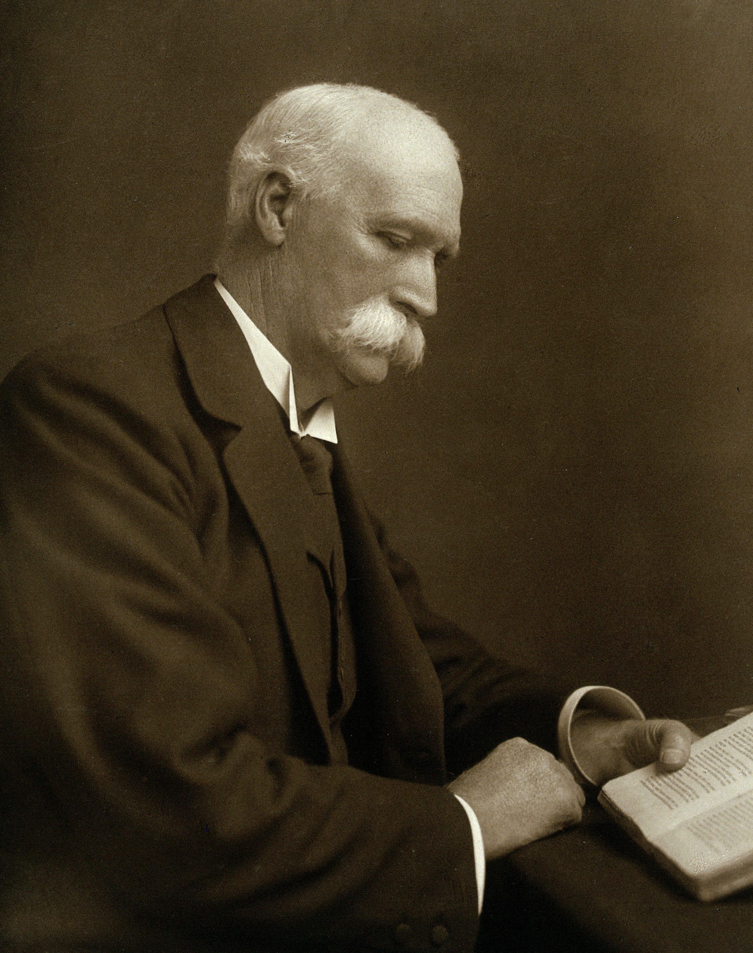 MACEWEN, Sir William (1848 – 1924)
