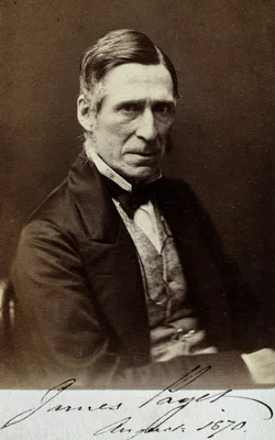 PAGET, Sir James (1814 – 1899)